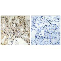 LATS1 antibody