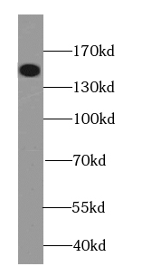 LATS2-Specific antibody