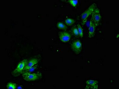 LAX1 antibody