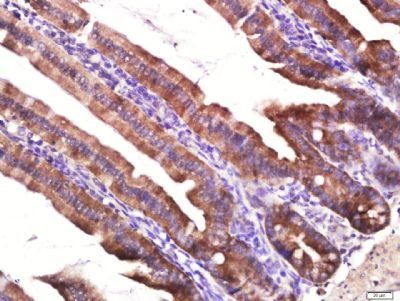 Layilin Rabbit Polyclonal Antibody