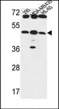 Lc3 synthase antibody