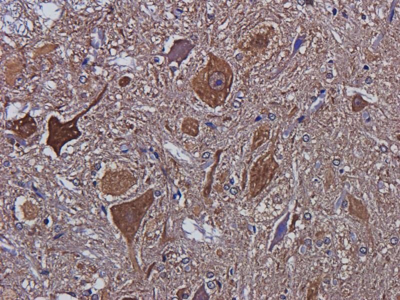 LC3 Rabbit Polyclonal Antibody