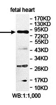 LCA5 Rabbit Polyclonal Antibody