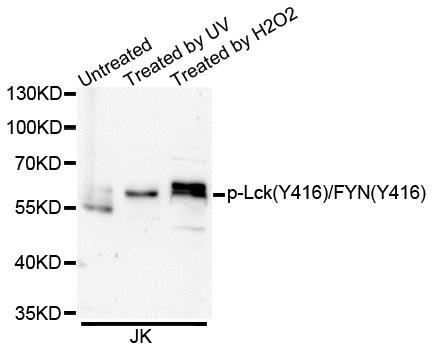Lck (Phospho-Y416/FYN-Y416) antibody