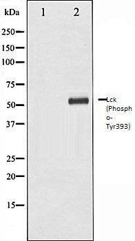 Lck (Phospho-Tyr393) antibody