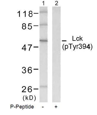 Lck (Phospho-Tyr394) Antibody