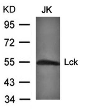 Lck(Ab-394) Antibody