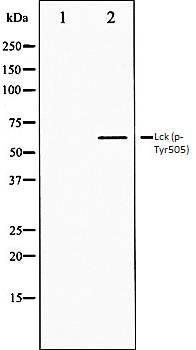 Lck (phospho-Tyr505) antibody