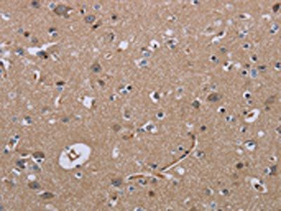 LCMT1 Antibody