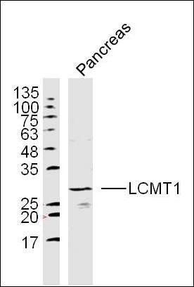 LCMT1 Rabbit Polyclonal Antibody