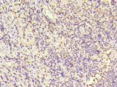 LCP1 Antibody