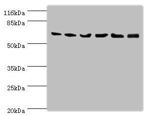 LCP1 Antibody