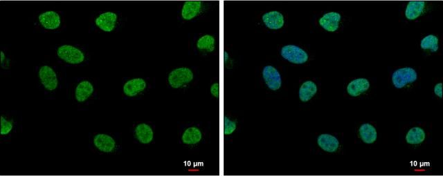 LDB1 antibody