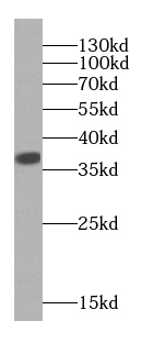 LDHA-Specific antibody