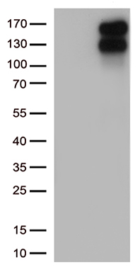 LDL Receptor (LDLR) antibody