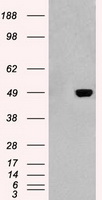 LDL Receptor (LDLR) antibody