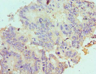 LDLRAP1 Antibody