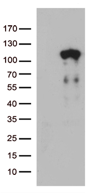 Lebercilin (LCA5) antibody