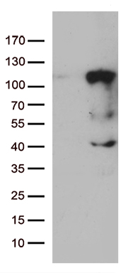 Lebercilin (LCA5) antibody