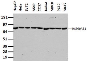 Lebercilin (LCA5) antibody