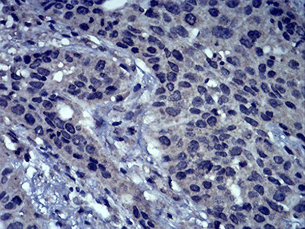 LEF1 Antibody