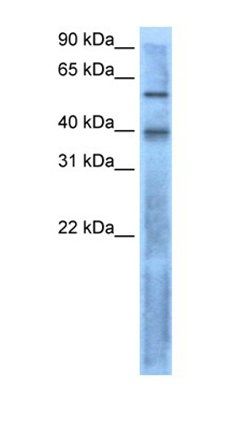 LEFTY2 antibody