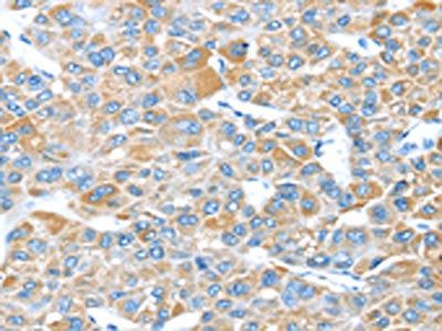 LEFTY2 Antibody