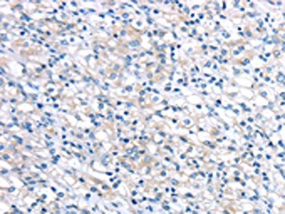 LEFTY2 Antibody
