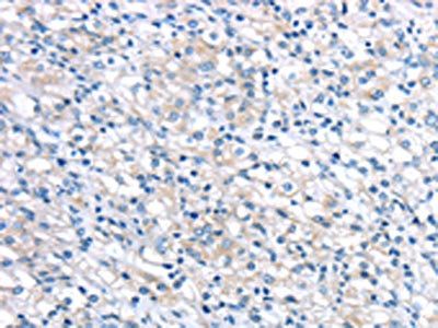 LEFTY2 antibody