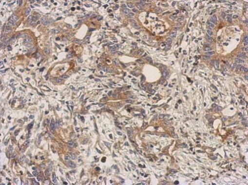 LEFTY2 antibody