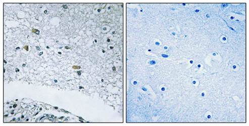 LAMC3 Antibody