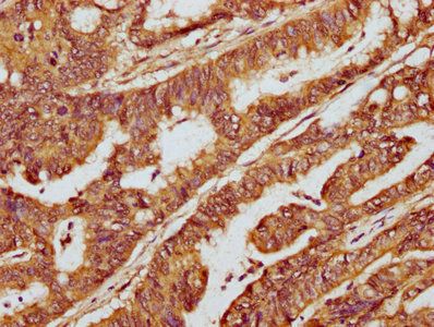 LEMD1 Antibody