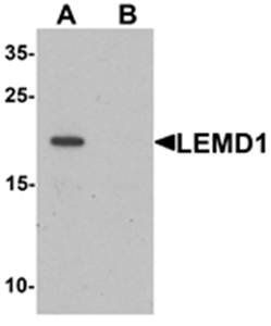 LEMD1 Antibody