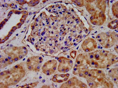 LEMD2 Antibody