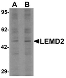 LEMD2 Antibody