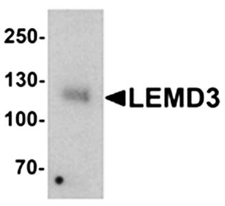 LEMD3 Antibody