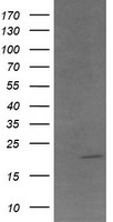 LEPRE1 (P3H1) antibody
