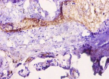 LEP Antibody