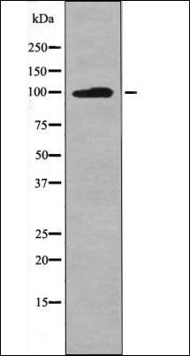 Leptin Receptor (Phospho-Tyr986) antibody