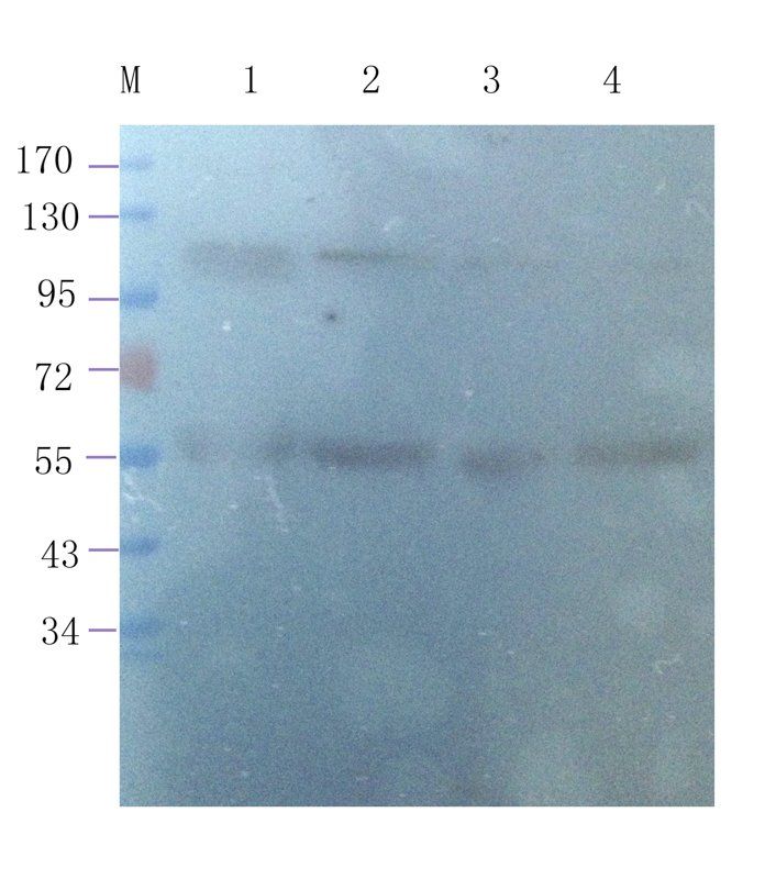 Leptin Receptor antibody