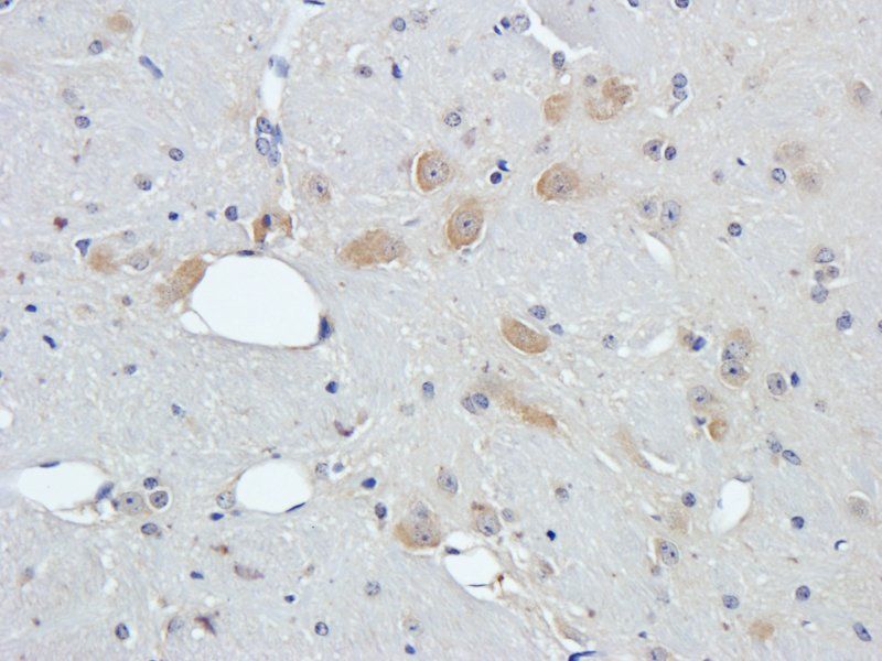 Leptin Receptor Rabbit Polyclonal Antibody