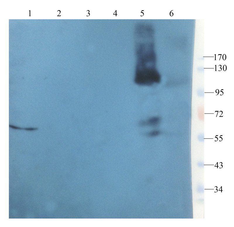 Leptin Receptor Rabbit Polyclonal Antibody