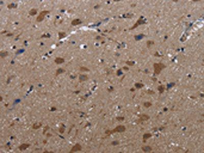 LETMD1 Antibody