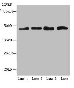 Leukocyte elastase inhibitor antibody