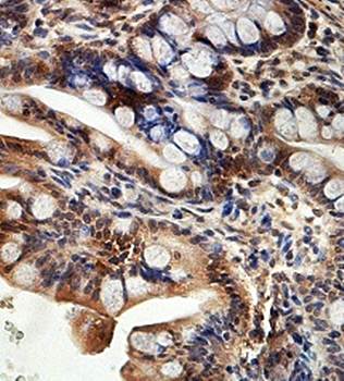 LGALS13 Rabbit Polyclonal Antibody