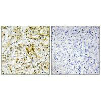 LGALS4 Antibody