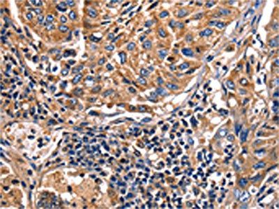 LGALS8 Antibody