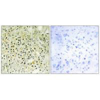 LGALS8 Antibody