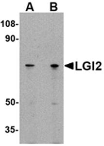 LGI2 Antibody