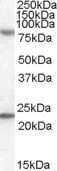 DHX58 antibody